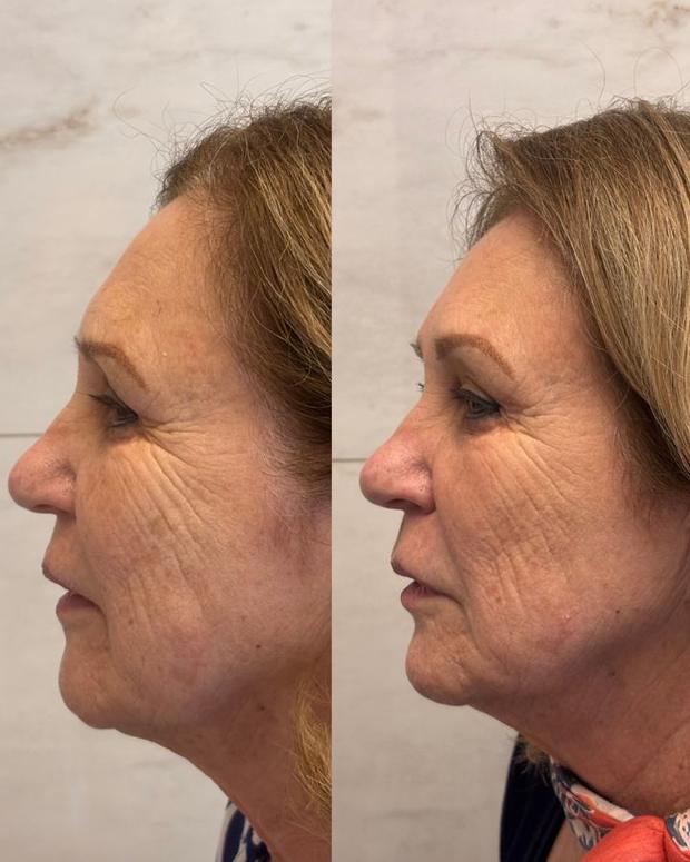 Antes e depois de abordagem integrada