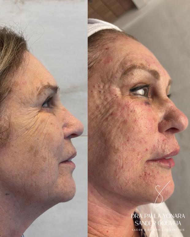 Antes e depois de abordagem integrada