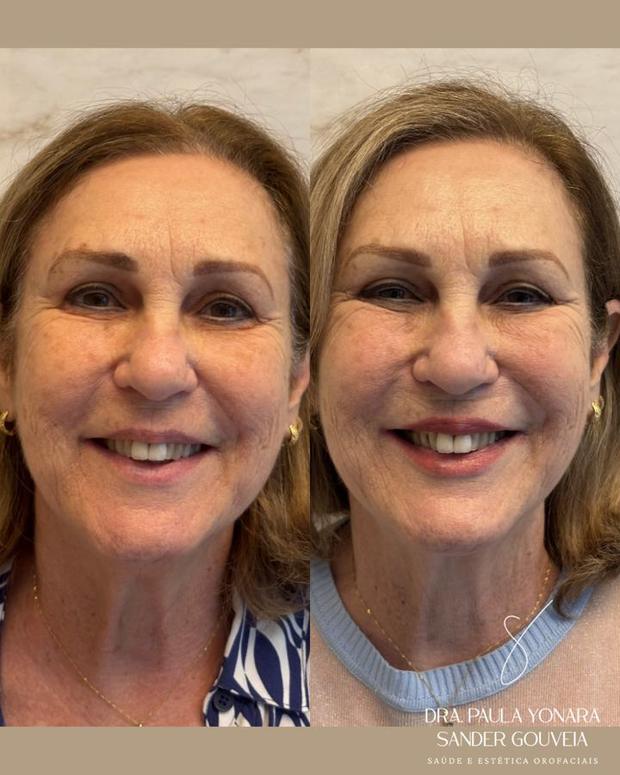 Antes e depois de abordagem integrada