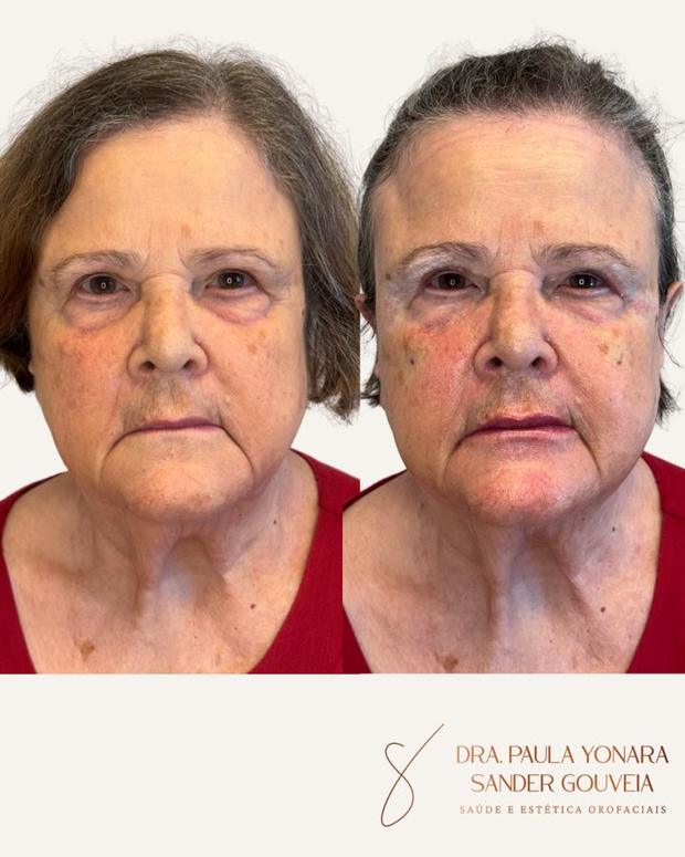 Antes e depois de abordagem integrada