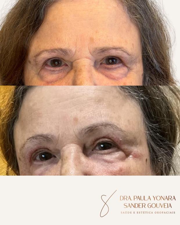 Antes e depois de abordagem integrada